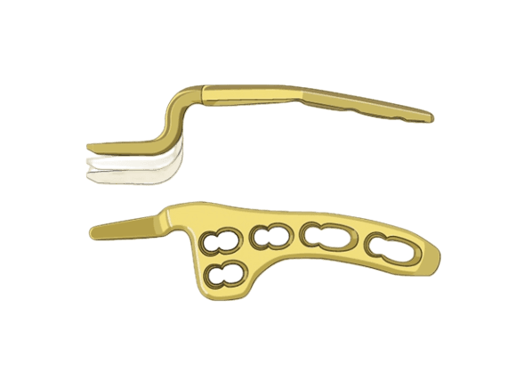 Locking Clavicle Hook Plate